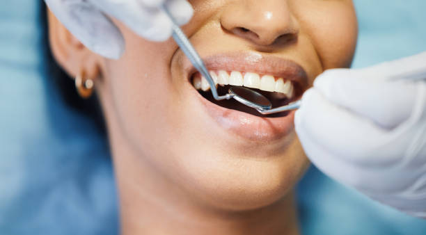 Best Emergency Dentist for Lost Fillings or Crowns in Twin Grove, IL
